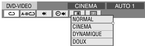 DVD-VIDEO CINEMA AUTO 1 A-B NORMAL CINEMA DYNAMIQUE DOUX