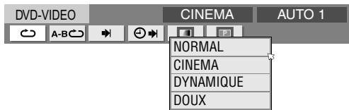 DVD-VIDEO CINEMA AUTO 1 A-B NORMAL CINEMA DYNAMIQUE DOUX