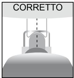 METRONIC TERMINAL NUMERIQUE ZAPBOX TWIN 3 - Montaggio della parabola sul motore - 1