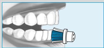 BRAUN ORALB PROFESSIONALCARE D17.525 - Vlákna INDICATOR® - 13