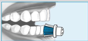 BRAUN ORALB PROFESSIONALCARE D17.525 - INDICATOR® kefefej - 4