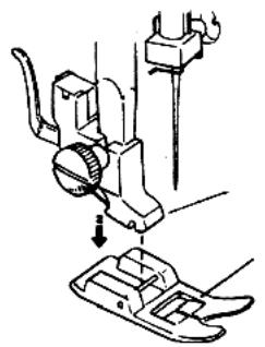 QUIGG MD 11836 - Mettre en place - 1