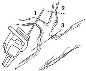 JONSERED CS 2172 - Élagage - 1