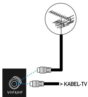MEDION LCD TV MD 30325 - Stromversorgung anschließen - 1