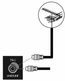MEDION LIFE X15002 MD 30238 - Priklop antene - 1