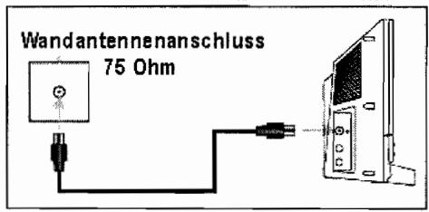 MEDION MD82479 - Prise antenne - 2