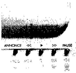 FRANCE TELECOM MADRIGAL - Ecouter les messages - 1