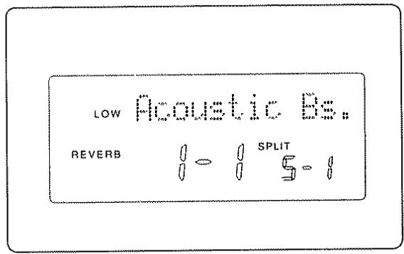 BOSS DS-330 - Fonctions que vous pouvez régler - 1