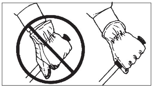 ECHO ES210 - Microtraumatismes répétés - 1