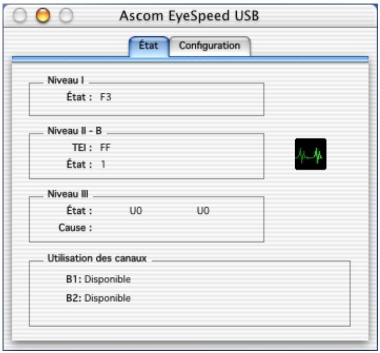 ASCOM EYESPEED USB - Identification et résolution des problèmes - 1