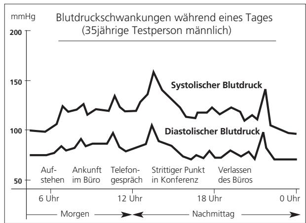 IBP A40 - Diastolischer Blutdruck - 1