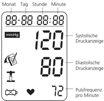 IBP A40 - Anzeige - 1
