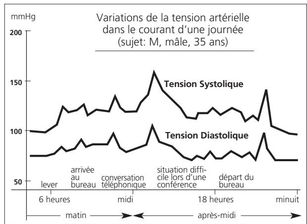 IBP A40 - Au sujet de la tension artérielle 3 - 1