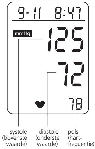 IBP A40 - Het toestel uitschakelen - 1