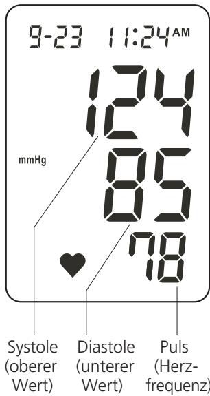 IBP BP 603 - die Durchführung einer Messung - 2