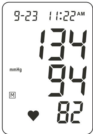 IBP BP 603 - der Messvorgang - 2