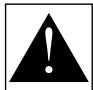 ARCAM P35 - Attention - 1