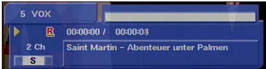 KATHREIN DVR UFD 558 - Enregistreur avec disque dur - 2