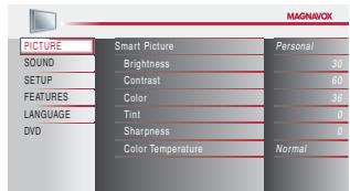MAGNAVOX 19MD359B - DVD Audio Setting - 2