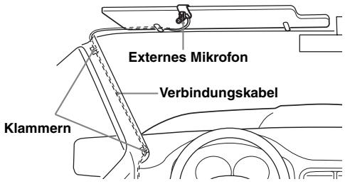 SONY MEX-BT3900U - Externes Mikrofon XA-MC10 - 1