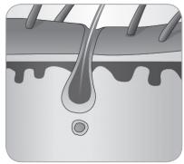 BABYLISS G933E - Dziafanie depilatora Homelight - 5