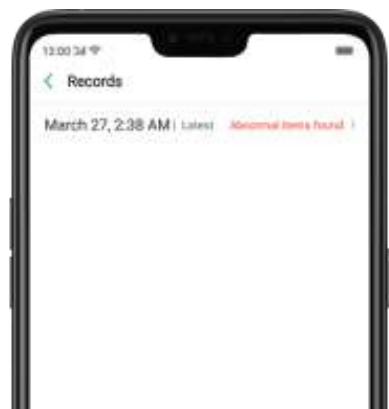 OPPO Find X - 7,6. Détention de problèmes courants - 6