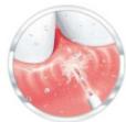 THOMSON TH3HYDROWATERPIKHYDROPULSEURWATERFLOSSERIRRIGADORIRRIGADORPy - 3verschillende modi - 3