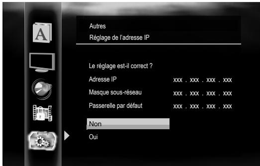 ONKYO DV-BD507 - Si vous sélectionnez "manuel", suivez les instructions suivantes pour définir l'adresse IP et DNS. - 2