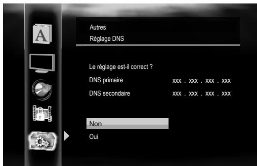 ONKYO DV-BD507 - Si vous sélectionnez "manuel", suivez les instructions suivantes pour définir l'adresse IP et DNS. - 4