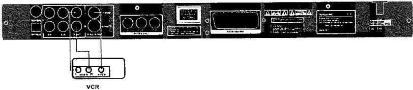 VCR