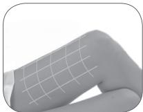 BABYLISS G972PE - Couverture de la zone de traitement - 1