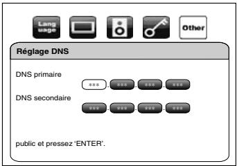 DENON DBP-2010 - Réglage DNS - 1