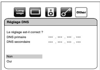 DENON DBP-2010 - Réglage DNS - 2