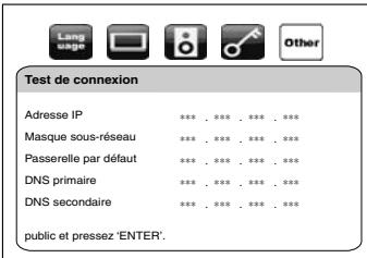 DENON DBP-2010 - Test de connexion - 1
