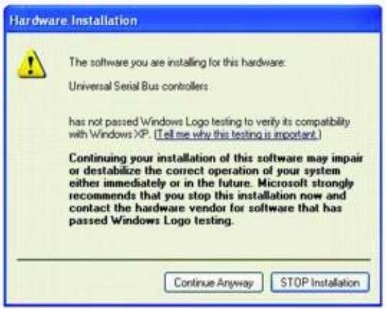 CREATIVE WebCam Live - Pour windows XP - 1