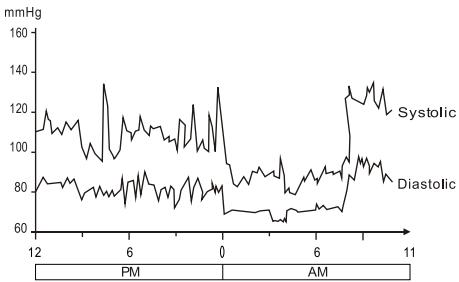 THOMSON TBPI801 - Fluctuation et variation de la pression sanguine - 1