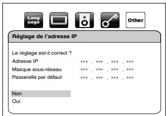 DENON DBP-1610 - Réglage de l'adresse IP - 5