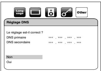 DENON DBP-1610 - Réglage DNS - 2