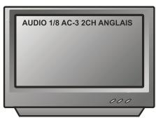 PEEKTON PK6749 - Fonction AUDIO - 1