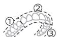 PHILIPS HX9911/88 - BrushPacer - 1