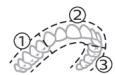 PHILIPS HX9911/88 - BrushPacer - 1