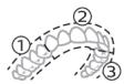 PHILIPS HX9911/88 - BrushPacer - 1