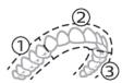 PHILIPS HX9911/88 - BrushPacer - 1