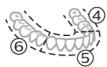 PHILIPS HX9911/88 - BrushPacer - 2