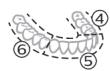 PHILIPS HX9911/88 - BrushPacer - 2