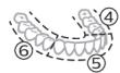 PHILIPS HX9911/88 - BrushPacer - 2