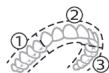 PHILIPS HX9911/88 - BrushPacer - 1