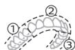 PHILIPS HX9911/88 - BrushPacer - 1