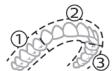 PHILIPS HX9911/88 - BrushPacer - 1