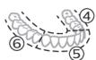 PHILIPS HX9911/88 - BrushPacer - 2